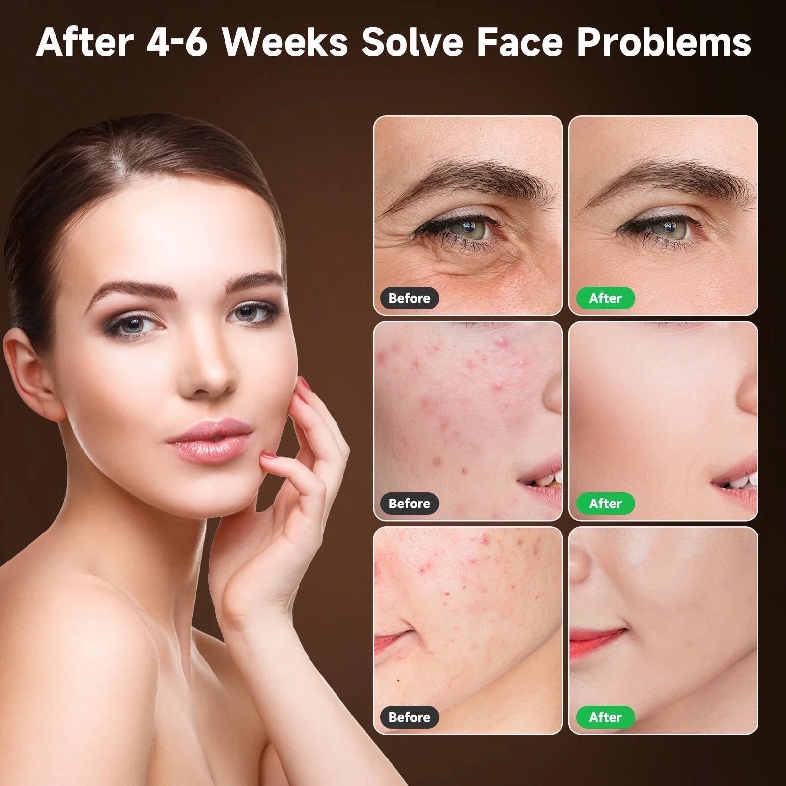 Red Light Therapy Mask 